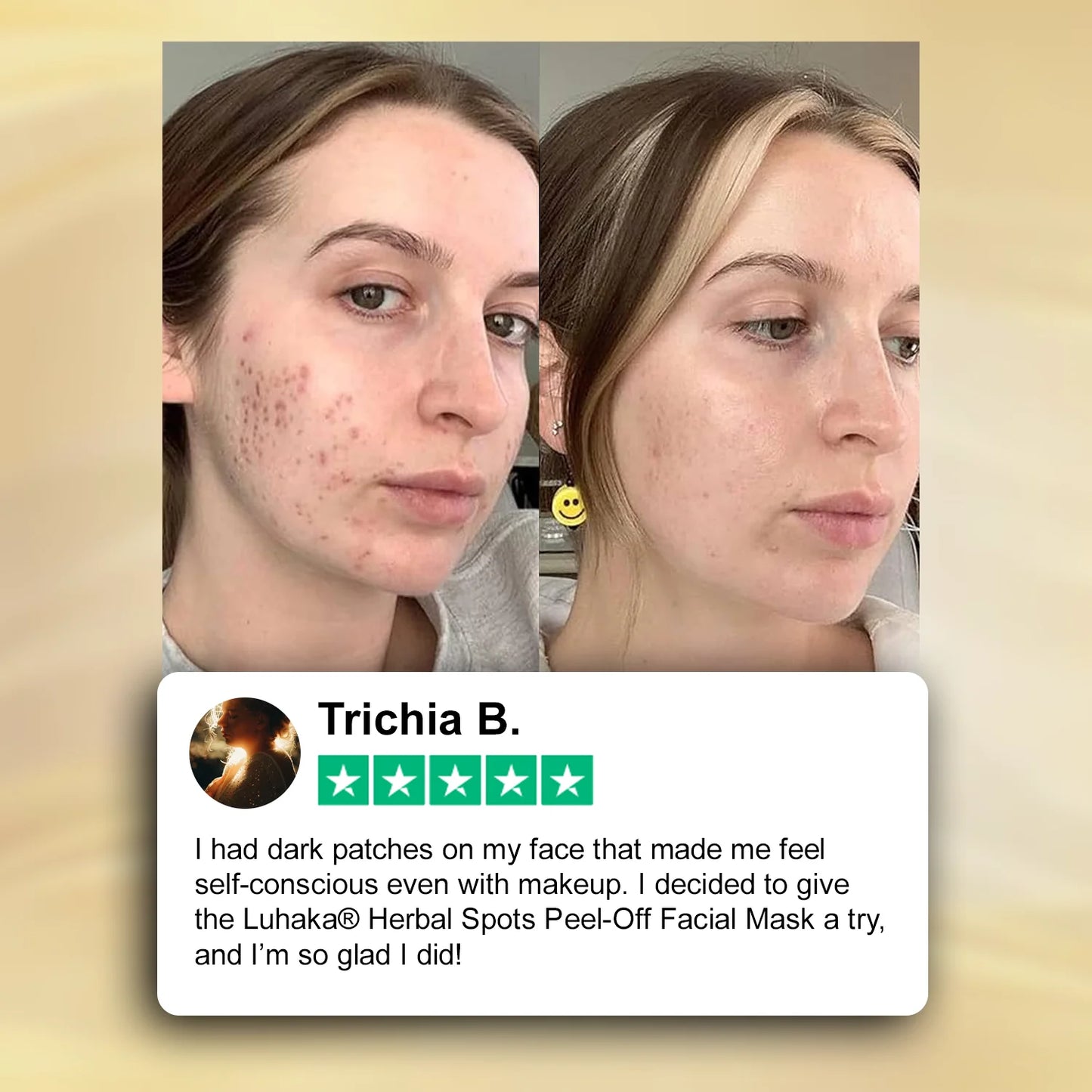Luhaka® Herbal Spots Feel-off Facial Mask 3