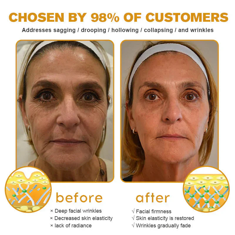 Raindew® Skin Treatment Cream Anti-aging, Hydrating, Skin Repair, Even Tone, Acne and Dark Spot Treatment, Wart and Mole Removal, Psoriasis Relief