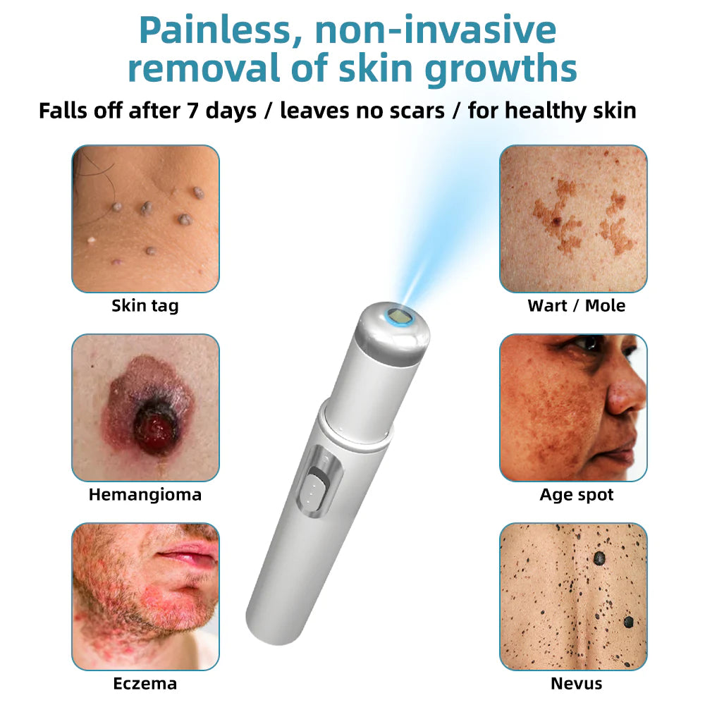 Total Skin Confidence Starts Here💫𝗞ı𝗱s𝗻𝗲𝗲𝗱® 𝗡𝗼𝗻-𝗜𝗻𝘃𝗮𝘀𝗶𝘃𝗲 𝗠𝗼𝗜𝗲 𝗮𝗻𝗱 𝗪𝗮𝗿𝘁 𝗥𝗲𝗺𝗼𝘃𝗮𝗜 𝗜𝗮𝘀𝗲𝗿 𝗣𝗲𝗻👨‍⚕️Developed by the American Academy of Dermatology Association (AAD)