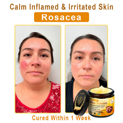 Raindew® Skin Treatment Cream Anti-aging, Hydrating, Skin Repair, Even Tone, Acne and Dark Spot Treatment, Wart and Mole Removal, Psoriasis Relief