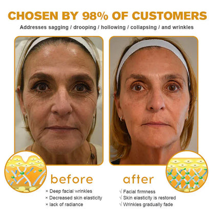 Raindew® Skin Treatment Cream Anti-aging, Hydrating, Skin Repair, Even Tone, Acne and Dark Spot Treatment, Wart and Mole Removal, Psoriasis Relief