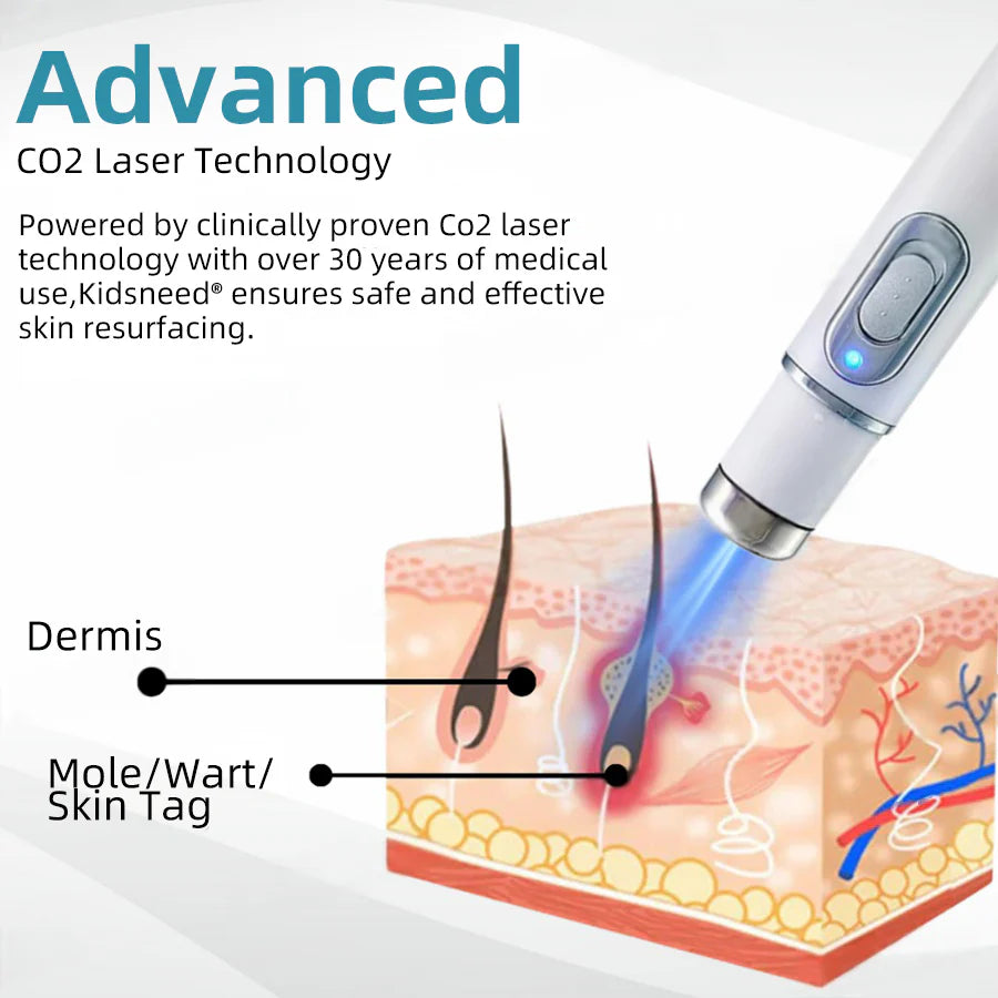 Total Skin Confidence Starts Here💫𝗞ı𝗱s𝗻𝗲𝗲𝗱® 𝗡𝗼𝗻-𝗜𝗻𝘃𝗮𝘀𝗶𝘃𝗲 𝗠𝗼𝗜𝗲 𝗮𝗻𝗱 𝗪𝗮𝗿𝘁 𝗥𝗲𝗺𝗼𝘃𝗮𝗜 𝗜𝗮𝘀𝗲𝗿 𝗣𝗲𝗻👨‍⚕️Developed by the American Academy of Dermatology Association (AAD)