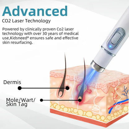 Total Skin Confidence Starts Here💫𝗞ı𝗱s𝗻𝗲𝗲𝗱® 𝗡𝗼𝗻-𝗜𝗻𝘃𝗮𝘀𝗶𝘃𝗲 𝗠𝗼𝗜𝗲 𝗮𝗻𝗱 𝗪𝗮𝗿𝘁 𝗥𝗲𝗺𝗼𝘃𝗮𝗜 𝗜𝗮𝘀𝗲𝗿 𝗣𝗲𝗻👨‍⚕️Developed by the American Academy of Dermatology Association (AAD)
