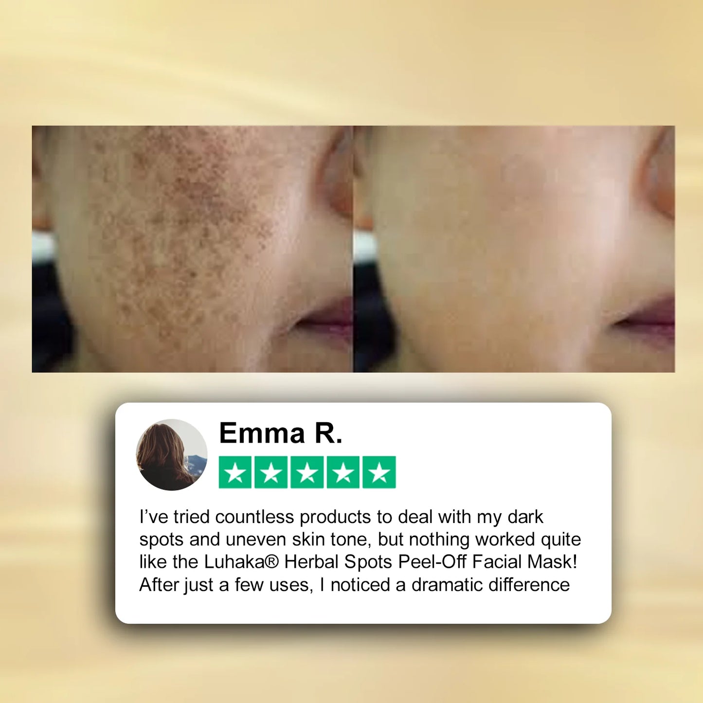 Luhaka® Herbal Spots Feel-off Facial Mask 3